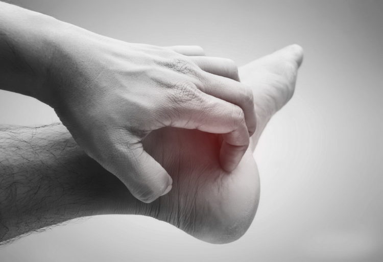 Dermatomicosis (iStock)