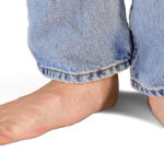 Los 5 consejos más comunes para la prevención y el tratamiento de los pies planos Pies planos.