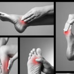 5 estiramientos para evitar el dolor de los pies Estiramientos para los pies (iStock).