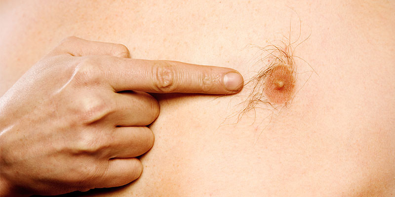 Pezones masculinos (iStock)