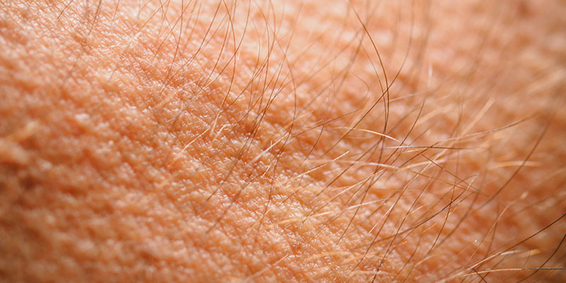 Los músculos que provocan la piel de gallina son una de las partes del cuerpo que ya no necesitamos (iStock)